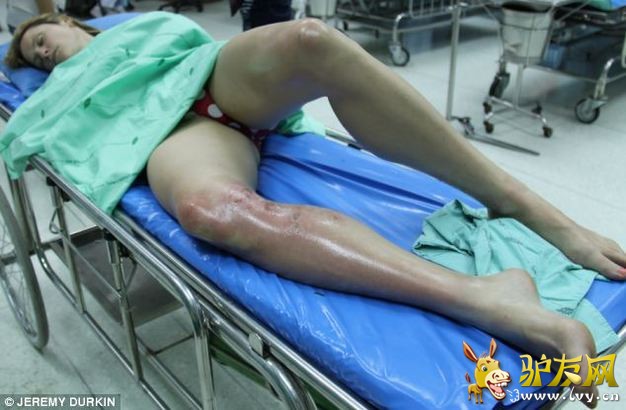 �̵�ȫ����Ϯ���ο͵Ŀֲ�˲��(1)_��ѧ̽��_������