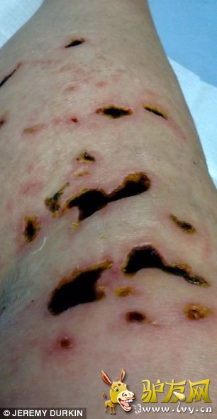 ��Ϥ����ķ����һ��Ǳˮ�б����˵ģ�ǰһ�뻹Ϊ�������е���ϲ�������������һ��͸��ܵ��������ϰٸ����������봩͸Ƥ�������Ĵ�ʹ�С�