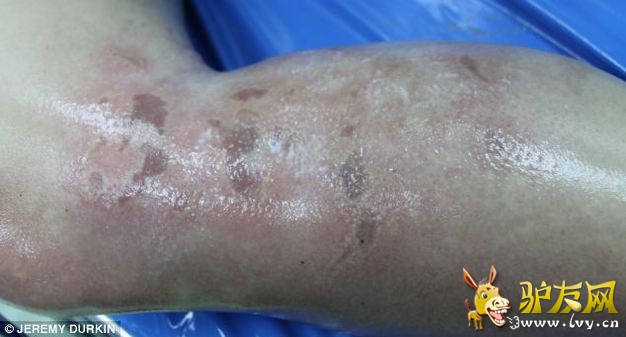 �̵�ȫ����Ϯ���ο͵Ŀֲ�˲��(1)_��ѧ̽��_������