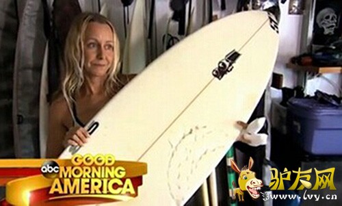 ������չʾ������ҧ���ĳ��˰�